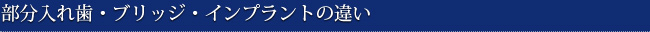 部分入れ歯・ブリッジ・インプラントの違い